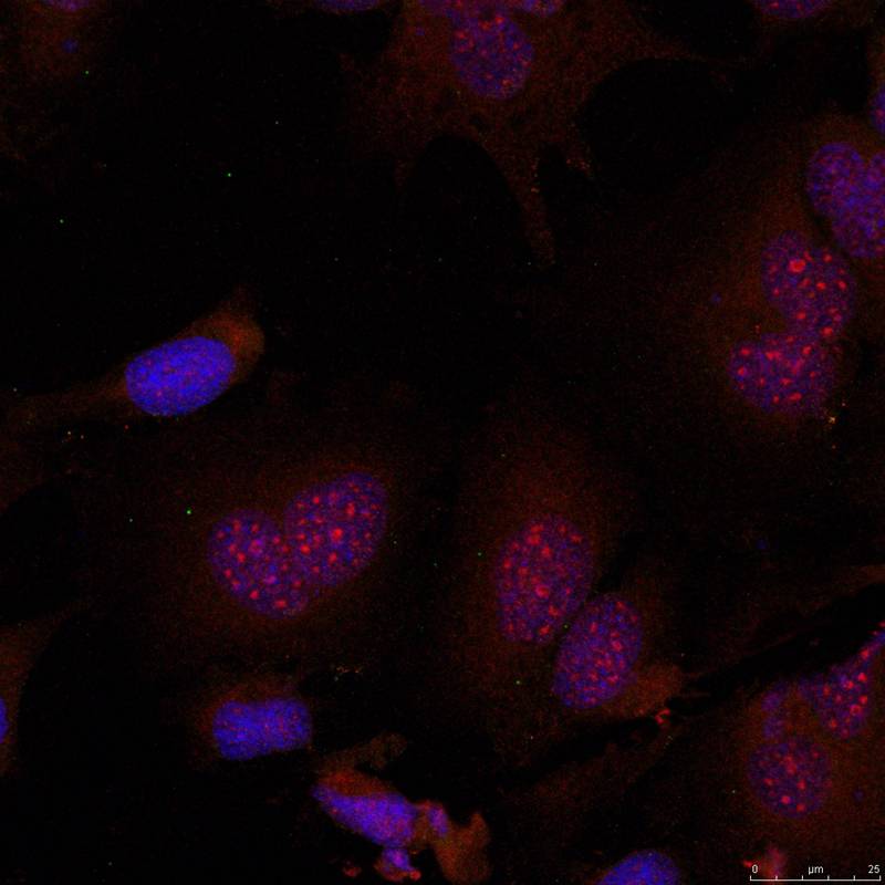 Rabbit Polyclonal Antibody to JunB(Phospho-Ser79)