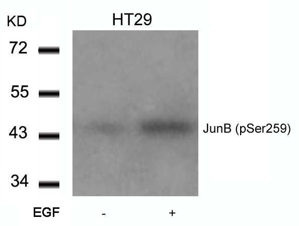 Rabbit Polyclonal Antibody to JunB(Phospho-Ser259)