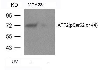 Rabbit Polyclonal Antibody to ATF2(Phospho-Ser62 or 44)