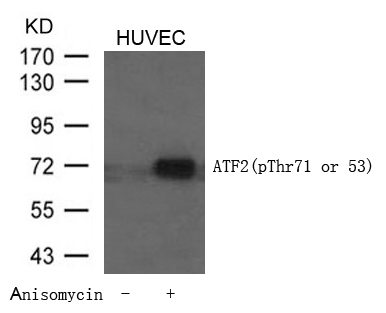 Rabbit Polyclonal Antibody to ATF2(Phospho-Thr71 or 53)