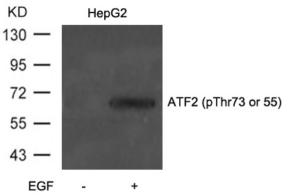 Rabbit Polyclonal Antibody to ATF2(Phospho-Thr73 or 55)