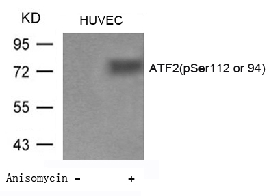 Rabbit Polyclonal Antibody to ATF2(Phospho-Ser112 or 94)
