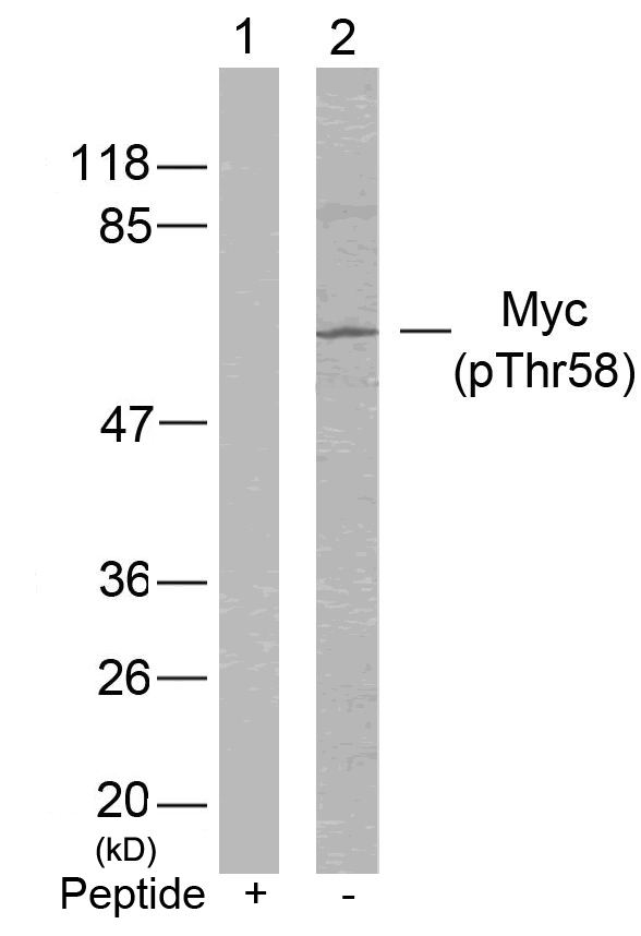 Rabbit Polyclonal Antibody to Myc(Phospho-Thr58)