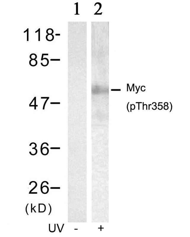 Rabbit Polyclonal Antibody to Myc(Phospho-Thr358)