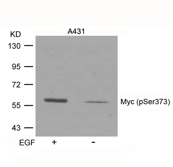 Rabbit Polyclonal Antibody to Myc(Phospho-Ser373)