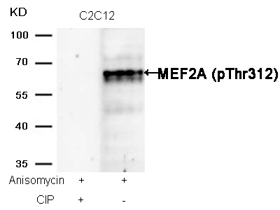 Rabbit Polyclonal Antibody to MEF2a(Phospho-Thr312)