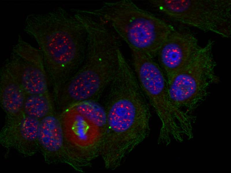 Rabbit Polyclonal Antibody to MEF2a(Phospho-Thr319)
