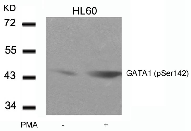 Rabbit Polyclonal Antibody to GATA1(Phospho-Ser142)