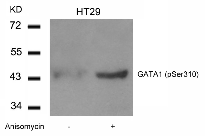 Rabbit Polyclonal Antibody to GATA1(Phospho-Ser310)