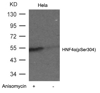 Rabbit Polyclonal Antibody to HNF4a(Phospho-Ser304)