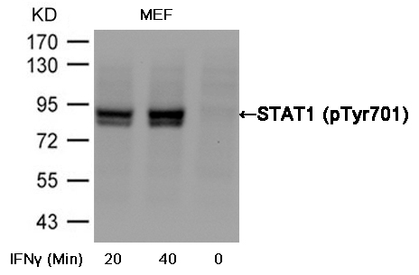Rabbit Polyclonal Antibody to STAT1(Phospho-Tyr701)