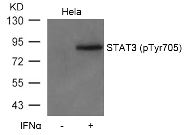 Rabbit Polyclonal Antibody to STAT3(Phospho-Tyr705)