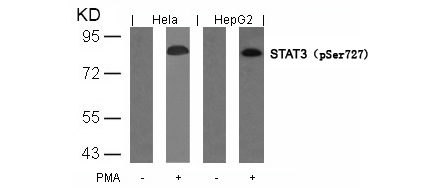 Rabbit Polyclonal Antibody to STAT3(Phospho-Ser727)