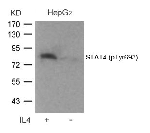 Rabbit Polyclonal Antibody to STAT4(Phospho-Tyr693)