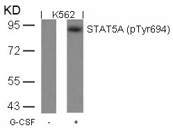 Rabbit Polyclonal Antibody to STAT5a(Phospho-Tyr694)