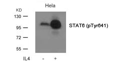 Rabbit Polyclonal Antibody to STAT6(Phospho-Tyr641)