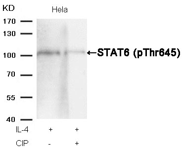 Rabbit Polyclonal Antibody to STAT6(Phospho-Thr645)