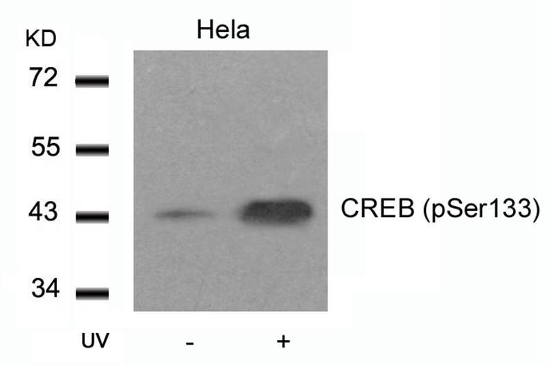 Rabbit Polyclonal Antibody to CREB(Phospho-Ser133)