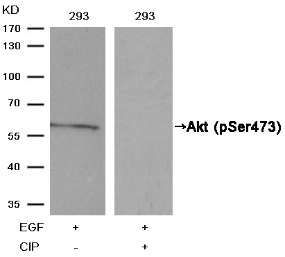 Rabbit Polyclonal Antibody to Akt(Phospho-Ser473)