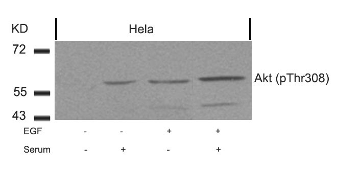 Rabbit Polyclonal Antibody to Akt(Phospho-Thr308)