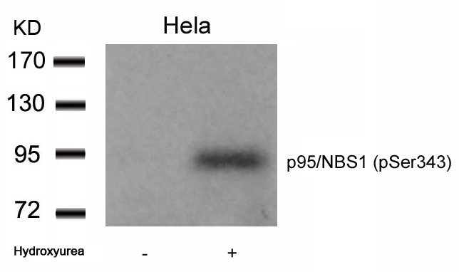 Rabbit Polyclonal Antibody to p95/NBS1(Phospho-Ser343)