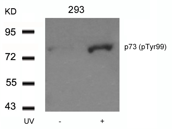 Rabbit Polyclonal Antibody to p73(Phospho-Tyr99)