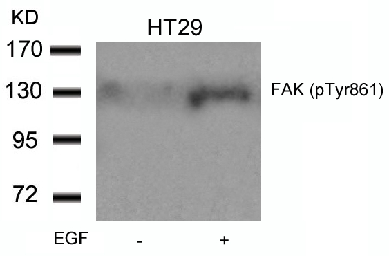 Rabbit Polyclonal Antibody to FAK(Phospho-Tyr861)
