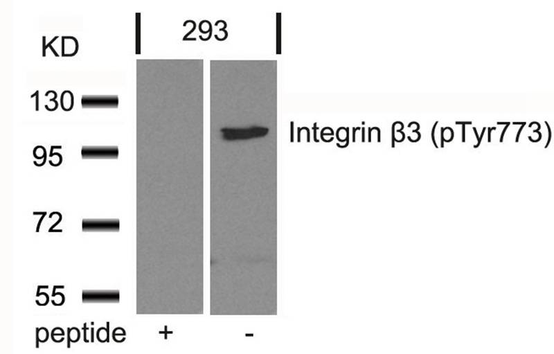 Rabbit Polyclonal Antibody to Integrin b3(Phospho-Tyr773)