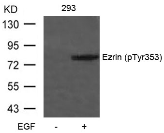 Rabbit Polyclonal Antibody to Ezrin(Phospho-Tyr353)