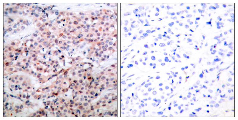 Rabbit Polyclonal Antibody to BCL-2(Phospho-Thr56)