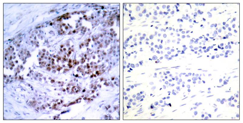 Rabbit Polyclonal Antibody to BCL-2(Phospho-Ser70)