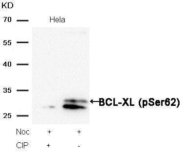 Rabbit Polyclonal Antibody to BCL-XL(Phospho-Ser62)