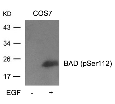 Rabbit Polyclonal Antibody to BAD(Phospho-Ser112)