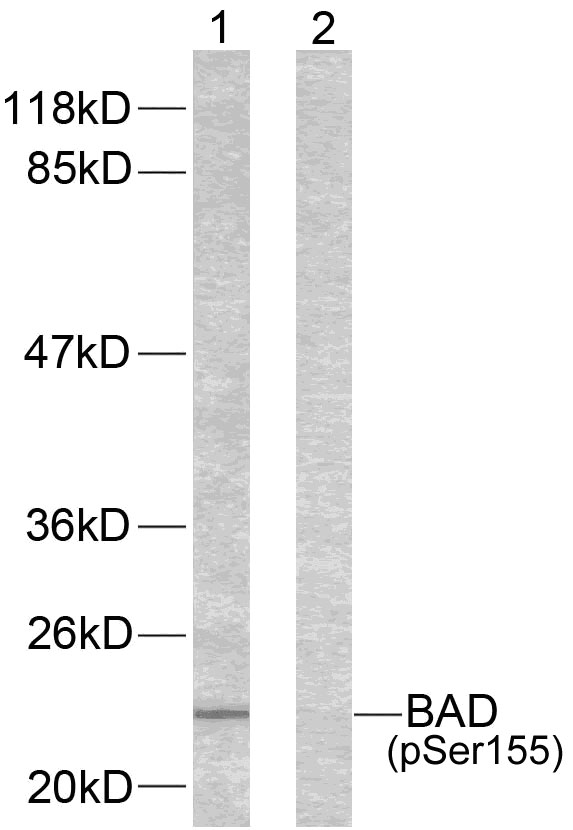 Rabbit Polyclonal Antibody to BAD(Phospho-Ser155)