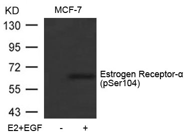 Rabbit Polyclonal Antibody to Estrogen Receptor-a(Phospho-Ser104)