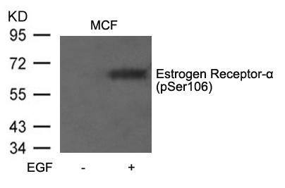 Rabbit Polyclonal Antibody to Estrogen Receptor-a(Phospho-Ser106)