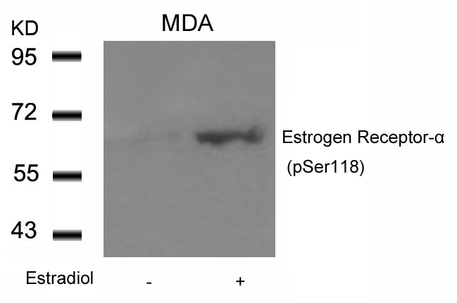 Rabbit Polyclonal Antibody to Estrogen Receptor-a(Phospho-Ser118)