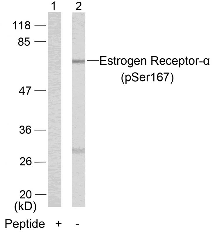 Rabbit Polyclonal Antibody to Estrogen Receptor-a(Phospho-Ser167)