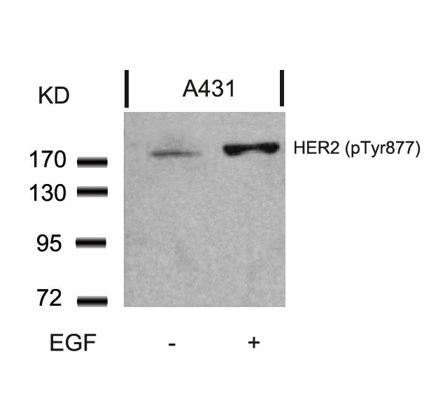 Rabbit Polyclonal Antibody to HER2(Phospho-Tyr877)