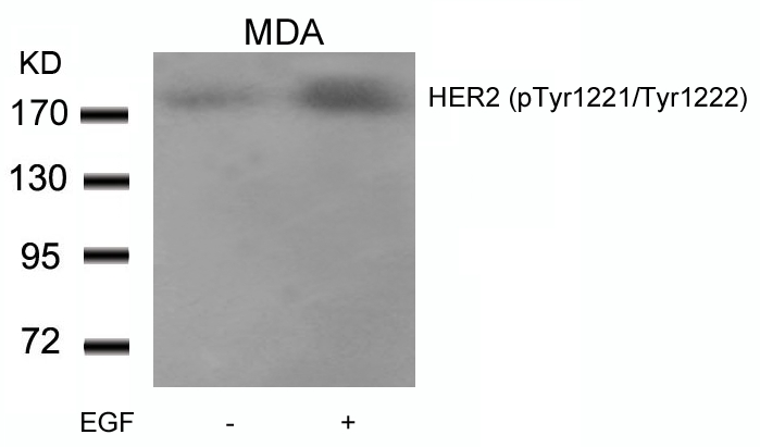 Rabbit Polyclonal Antibody to HER2(Phospho-Tyr1221/Tyr1222)
