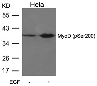 Rabbit Polyclonal Antibody to MyoD(Phospho-Ser200)