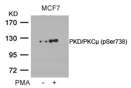 Rabbit Polyclonal Antibody to PKD/PKCm(Phospho-Ser738)