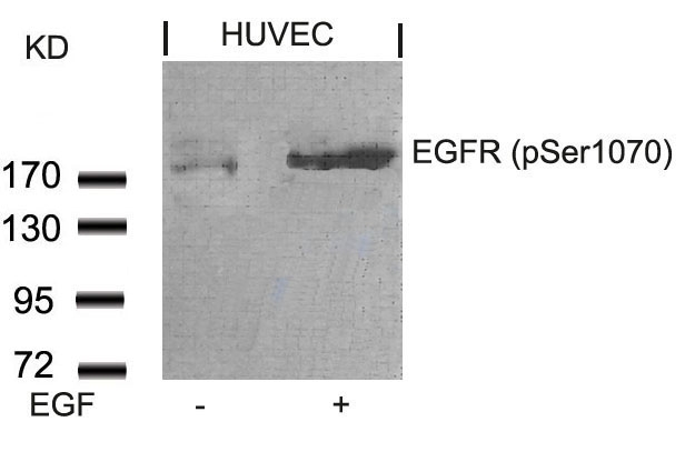 Rabbit Polyclonal Antibody to EGFR(Phospho-Ser1070)