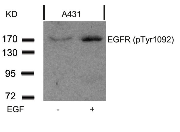 Rabbit Polyclonal Antibody to EGFR(Phospho-Tyr1092)
