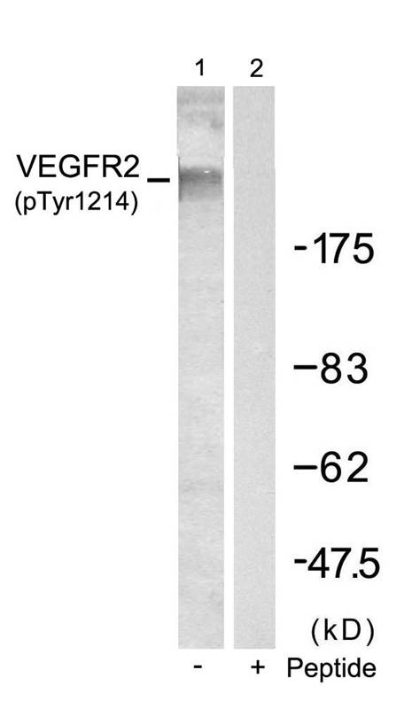Rabbit Polyclonal Antibody to VEGFR2(Phospho-Tyr1214)
