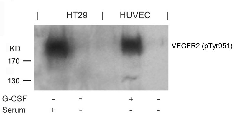 Rabbit Polyclonal Antibody to VEGFR2(Phospho-Tyr951)