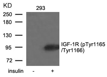 Rabbit Polyclonal Antibody to IGF-1R(Phospho-Tyr1165/Tyr1166)