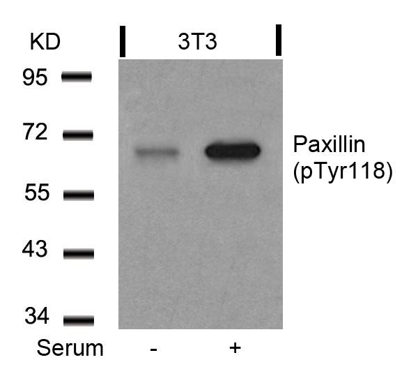 Rabbit Polyclonal Antibody to Paxillin(Phospho-Tyr118)