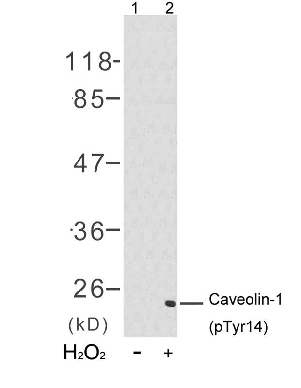 Rabbit Polyclonal Antibody to Caveolin-1(Phospho-Tyr14)