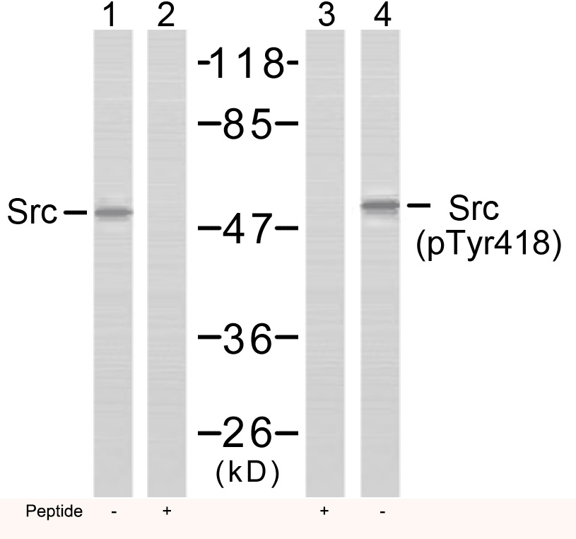 Rabbit Polyclonal Antibody to Src(Phospho-Tyr418)